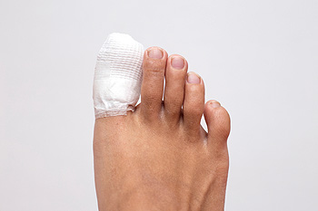 What Are the Symptoms of a Toe?