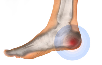 pain in foot heel causes
