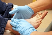 The Importance of Daily Foot Checks in Diabetic Patients