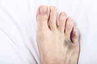 A Painful Pinky Toe